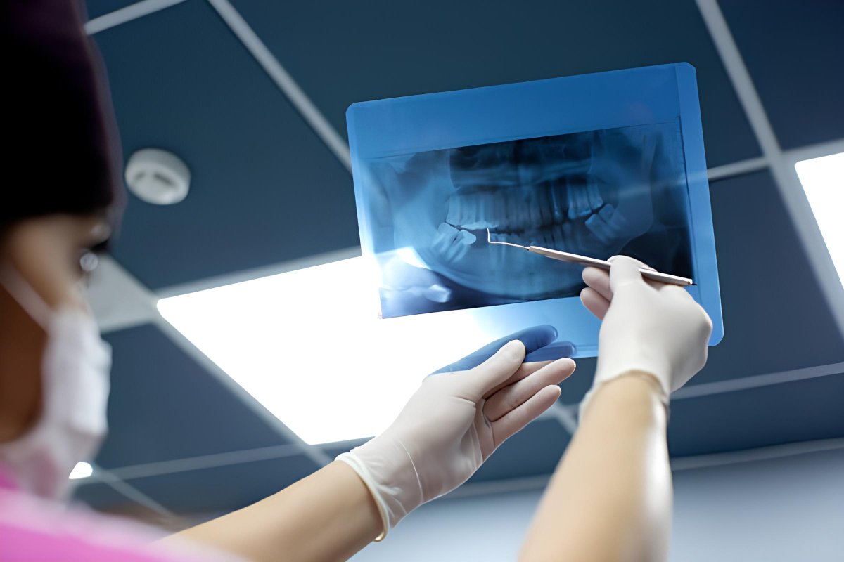 Dental Tomografi